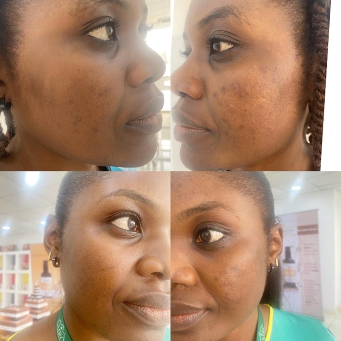 cookieskin skincare routine